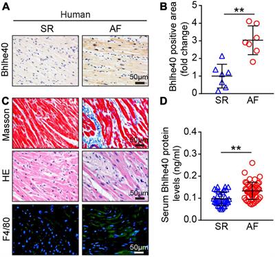 Cardiac-specific knockdown of Bhlhe40 attenuates angiotensin II (Ang II)-Induced atrial fibrillation in mice